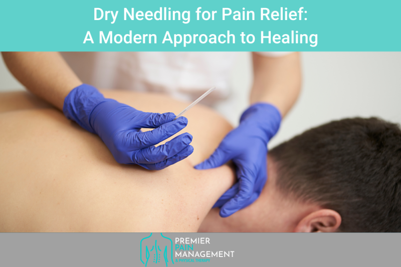 Dry Needling for Pain Relief A Modern Approach to Healing