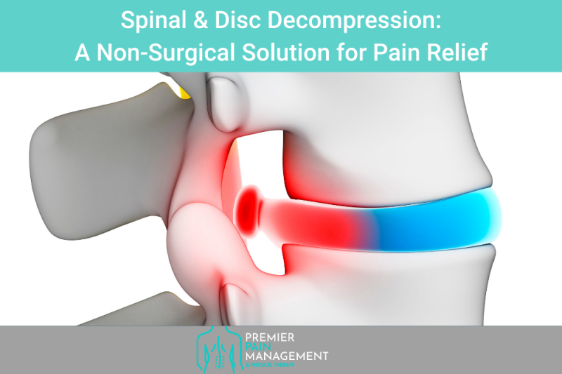 Spinal & Disc Decompression A Non-Surgical Solution for Pain Relief